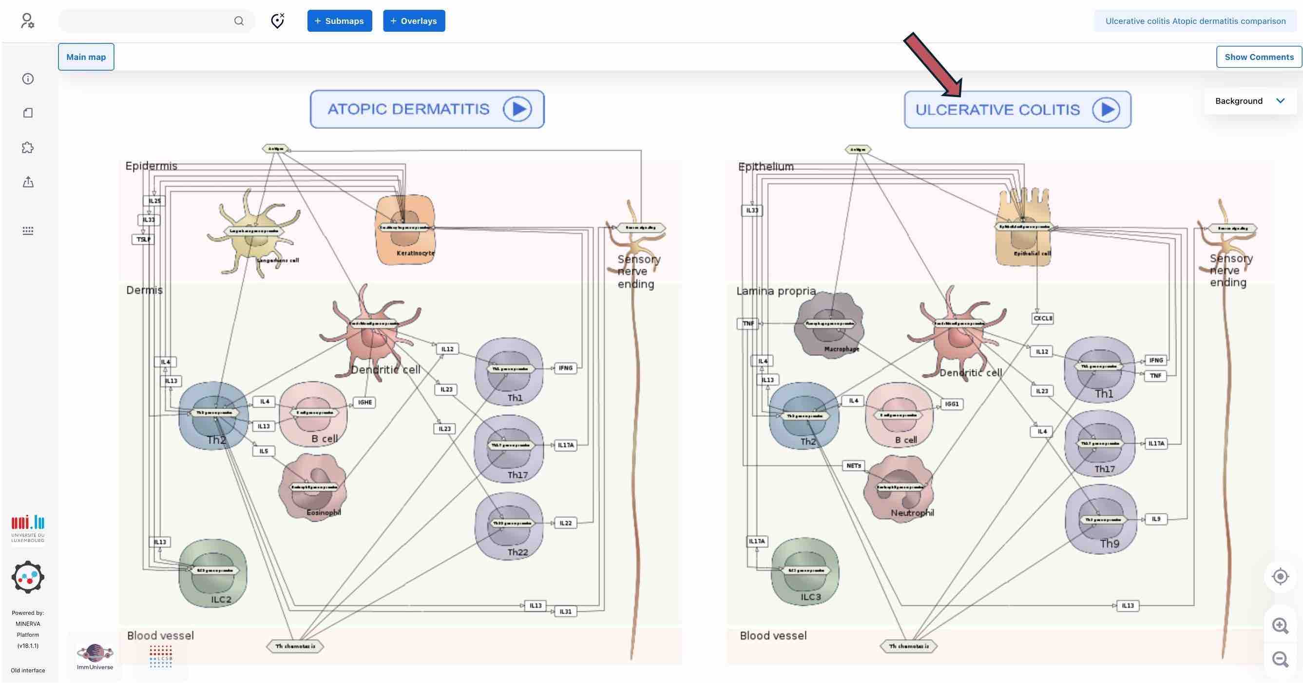 comparison diagram P1